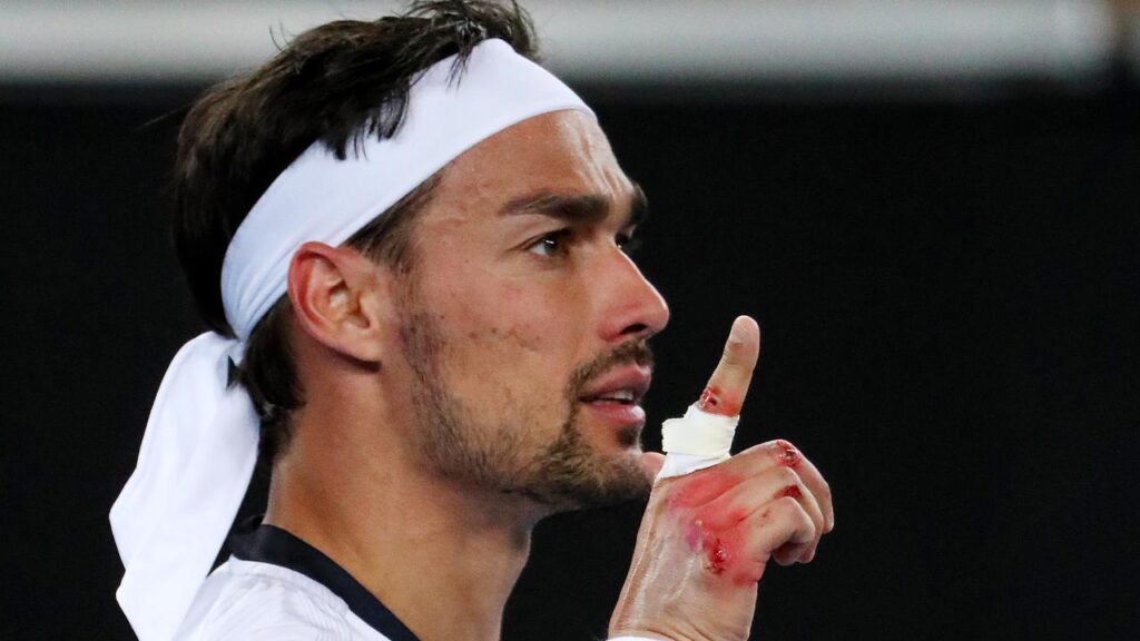 法比奧·福尼尼 Fabio Fognini 2020澳網